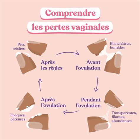 perte blanche infection|Pertes vaginales blanches et crémeuses : causes et。